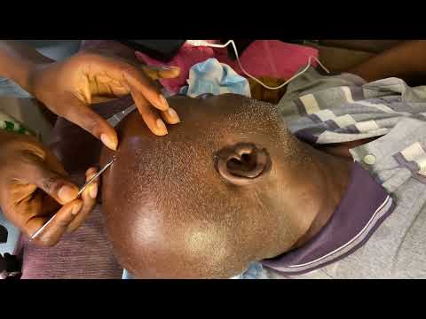 Scalp Massage Nitpicking & Scratching for Relaxing Sleep | ASMR Calming Experience