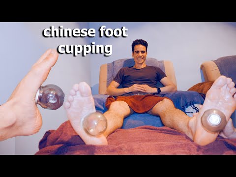 ASMR: Ho provato il MASSAGGIO CINESE ai Piedi con COPPETTAZIONE col FUOCO!