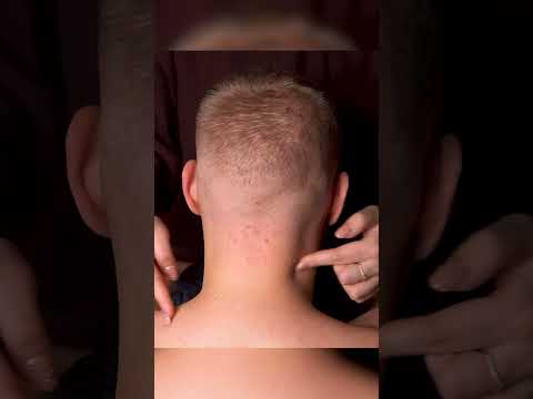 EXTREME SCALP MASSAGE #asmr #fast  #headscratching #scalpmassage #neckmassage #fastasmr