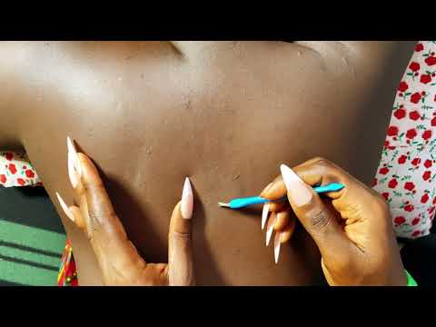 ASMR NIT PICKING AND SCRATCHING MY SISTERS BACK SHE FELL ASLEEP/ RELAXING ASMR