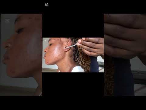 ASMR EAR CLEANING AND NITPICKING, SPIT PAINTING, EAR LICKING, EAR EATING, EAR BITTING, SCALP SCRATCH