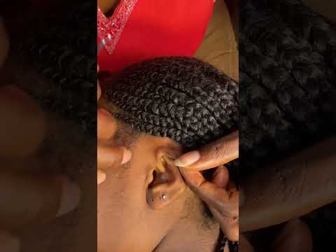 ASMR EAR CLEANING, SCALP SCRATCHING, GUM CHEWING #asmr
