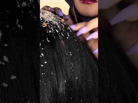 Clean your hair from sand 💆🏻‍♀️ #tingles #satisfying #asmrmassage #asmrscratching #asmr #shorts