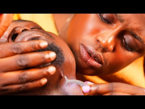 ASMR✨No talking,Deep Ear Cleaning, Ingrown Hair Pulling, Throat Massage & Long Nail Braid-scratch