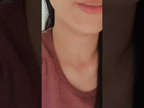 BIG GIANT BUG REMOVAL IN EARS 🙄🙄😣 #asmr #earcleaning #earcleaningasmr #earwaxremoval #earwaxcleaning