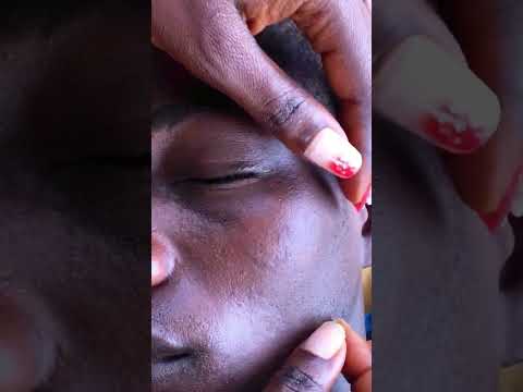 Face Nitpicking Asmr face Touching #satisfying #headscratching #asmrscratching #asmr #asmrsounds