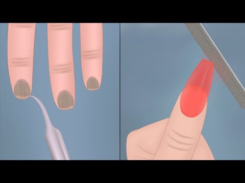 Split nails treatment|| Acrylic nails ASMR animation|| Manicure treatment||