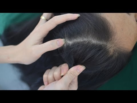 ASMR Hair Pulling, Hair Parting, Real Person Scalp Scratching Massage For Relaxation