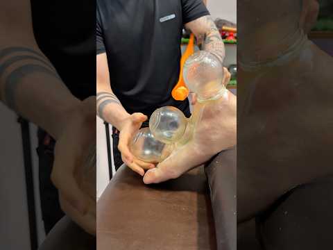 "ASMR"vip cupping alinezhad❤️😋 #trending #trendingshorts #fyp #shorts #explore #viralshorts
