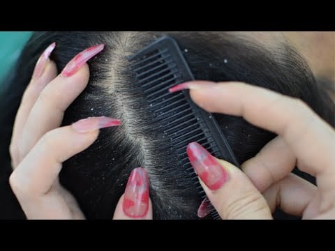ASMR Scalp Check With Comb On Real Person For Deep Sleep ( No Talking Asmr )