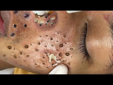 حلول طبيعية لبشرة صافية# 𝐒𝐤𝐢𝐧 𝐂𝐚𝐫𝐞 66893
