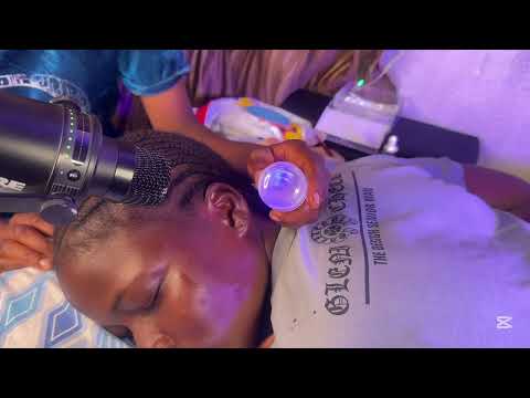 ASMR INTENSE EAR MASSAGE AND PICKING FOR PEOPLE WHO NEED SLEEP VERY SATISFYING