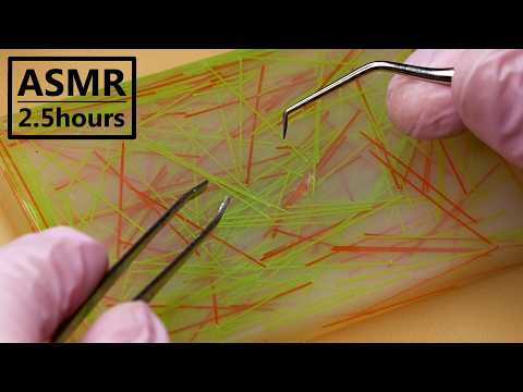 【ASMR 2.5h】ADHD向け 埋もれ毛を抜く10種の最強トリガー