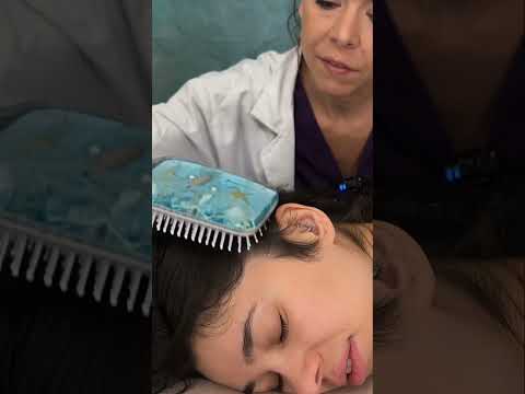 Asmr scalp tingles #asmr #asmrsounds #asmrvideo #relax #relaxing #satisfying #hair #sleep #tingles