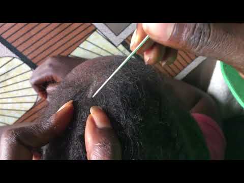 Asmr Scalp cleaning For Sleep. #satisfying #tingles #dandruff