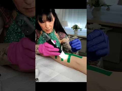 Special allergy test on the arm