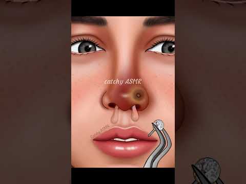 Nose Piercing Removal And Nasal Sinus Treatment Animation, Relaxing ASMR Animation. ASMR animation.