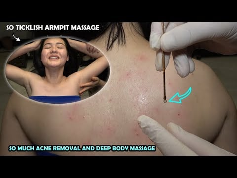 FEMALE SHOULDER DEEP ACNE REMOVAL + SO TICKLISH ARMPIT MASSAGE + CRACKS + ASMR Hip And Body Massage