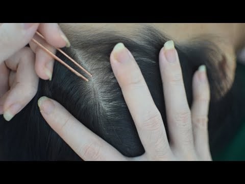 ASMR Scalp Scratching Aggressive Make You Feel Relieve Itchy ( No Talking )