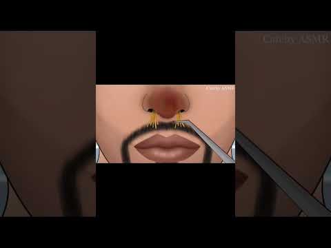 #asmranimation #stopmotionanimation #asmrvideo #nosepusremoval