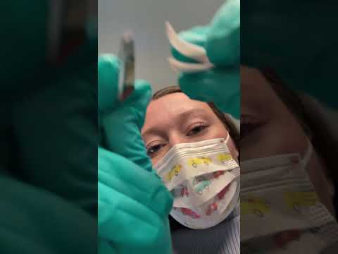 Opération 👩🏻‍⚕️ #asmr