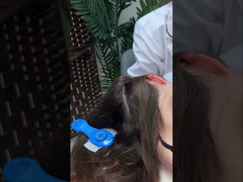 Asmr scalp tingles #asmr #asmrsounds #asmrvideo #relax #relaxing #satisfying #hair #sleep #tingles