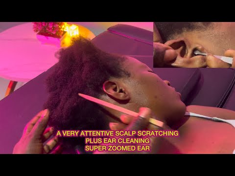 ASMR✨SUPER ZOOMED EAR CLEANING AND SCALP SCRATCHING, SLEEP TRIGGERS ON MY COUSIN