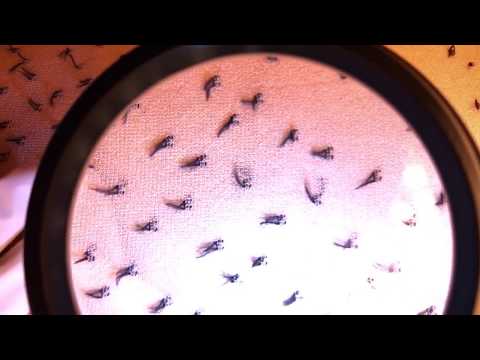 ❤️ ASMR FR - EPILATION - CHUCHOTEMENT PROCHE MICRO - remove ingrown hair roleplay