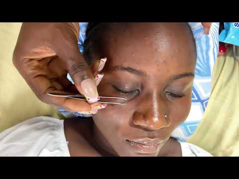 ASMR GENTLE FACE NITPICKING AND MASSAGE- SOFT TOUCHING WITH BUBBLEGUM
