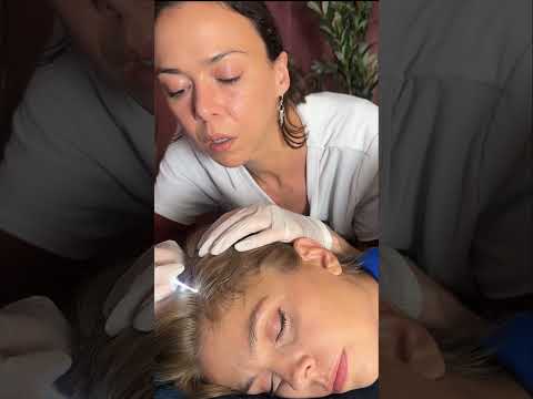 Asmr scalp tingles #asmr #asmrsounds #asmrvideo #relax #relaxing #satisfying #hair #sleep #tingles