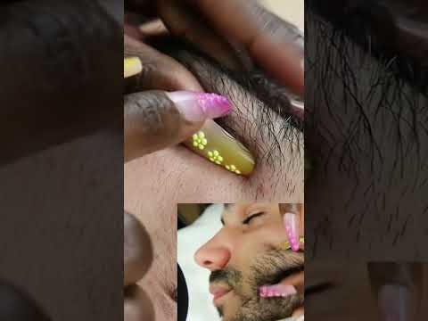 Beard picking #asmr #relax #fyp #foryoupage #viral #explorepage #nails #skincare #hair