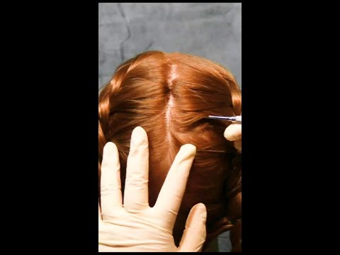 ASMR Scalp Check with Medical Instuments (Very Tingly) #shorts