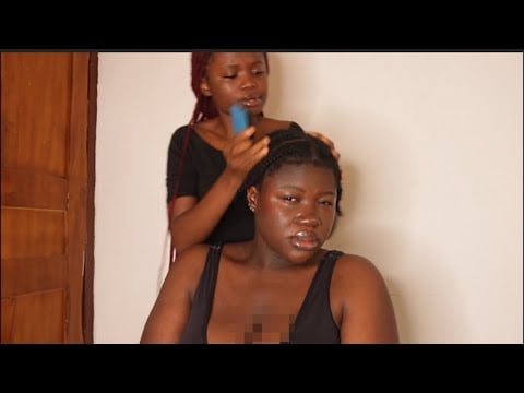 ASMR Fast & Aggressive Scalp Massage & Scratching For Sleep