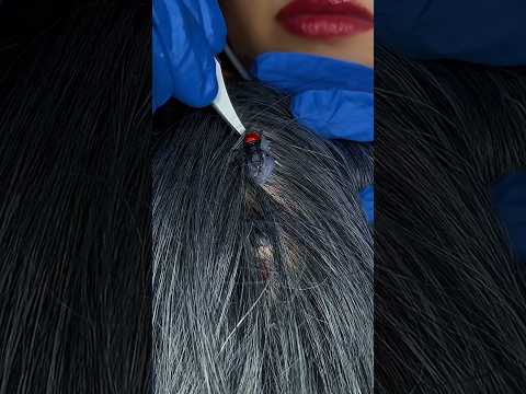 Bugs Plucking 🐜 #asmr #satisfying #visualtingle #relax #mouthwhisper #tingles