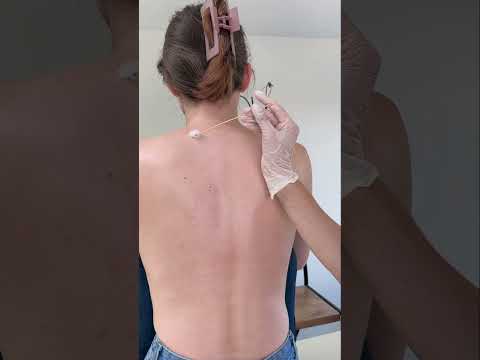 Asmr back exam #asmr #asmrsounds #asmrvideo #relaxing #relax #satisfying #satisfyingvideo #tingles