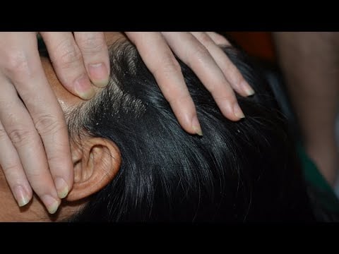 ASMR Scalp Check Dandruff - Scalp Scratching Sounds Relaxing For Sleep ( No Talking )