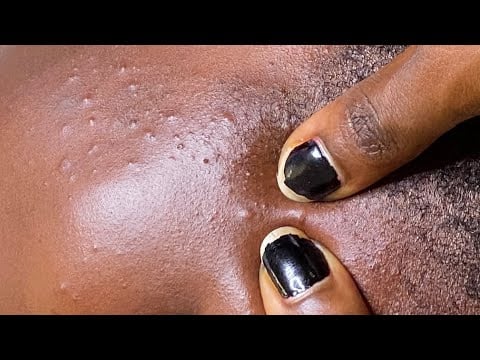 Asmr sleep and relaxation treatment
