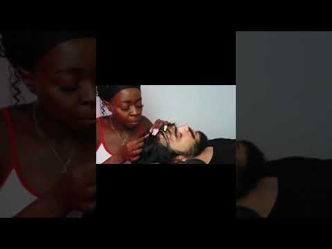 Nitpicking Whiteheads On Scalp | ASMR #Shorts #Youtubeshorts