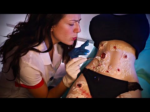 ASMR  | CUIDANDO DA SUA QUEIM4DURA (escamação,curativo,limpeza)