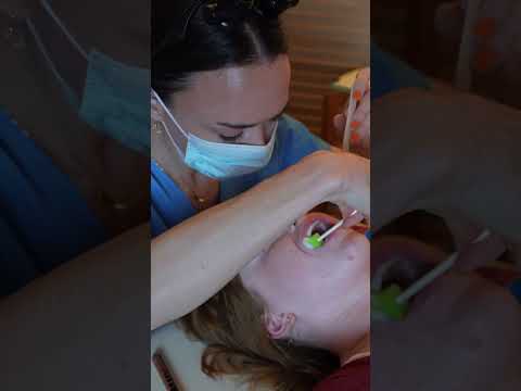 Asmr dental #asmr #asmrsounds #asmrvideo #relaxing #relax #satisfying #satisfyingvideo #tingles