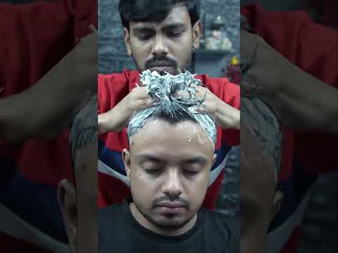 Satisfying Huge Dandruff Removal And Treatment ASMR | Satisfying Dandruff Video #shorts