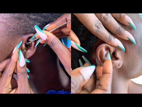 ✨Super ✨attentive ear cleaning on a real person- cracking bubbles- rain sound