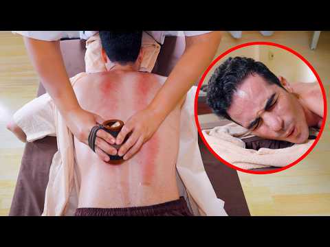 ASMR: Amazing Chinese Pressure Point Guasha Moxibustion Back Massage with Eye Spa