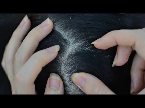 ASMR Relaxing Scalp Check For Deep Sleep / Real Person Scalp Scratching Relieve Itchy / No Talking