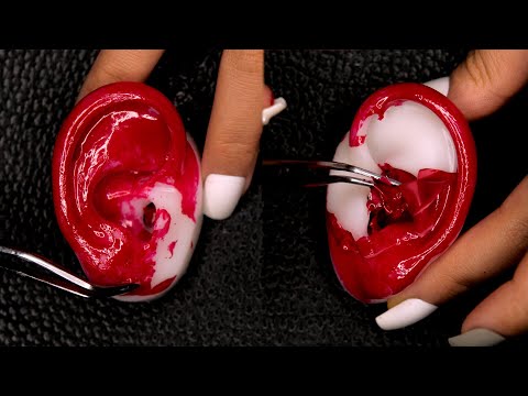 [ASMR] Crisp sound of peeling from ears (subtitles, ear cleaning, cotton swabs)