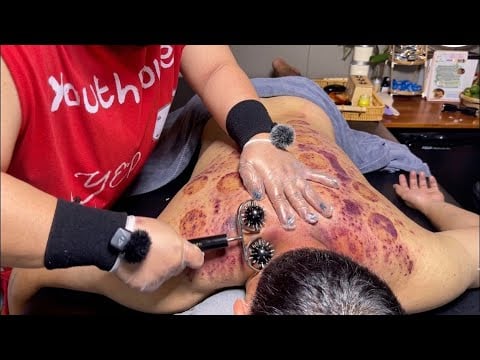 ASMR 🇻🇳 Can You Handle This Deep Back Therapy in Vietnam? | Pain Relief & Relaxation