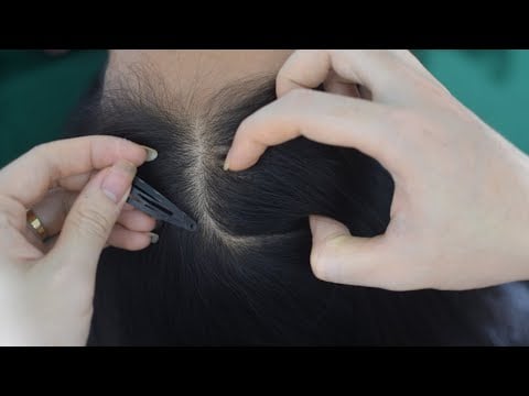 ASMR No Talking Scalp Scratching, Scalp Massage, Hair Combing On Real Person For Stress Relief