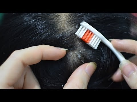 ASMR Scalp Scratching Sounds, Melting Scalp Massage With Toothbrush For Relaxation ( No Talking )