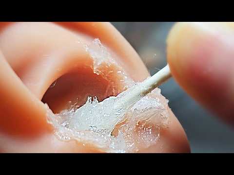 ASMR 물귀지💧 아주 깊은 곳까지 축축해지는 귀청소 (No Talking) Ear Cleaning