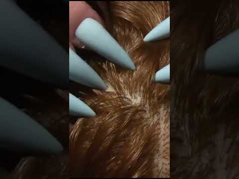ASMR Scalp Check with Long Nails #shorts